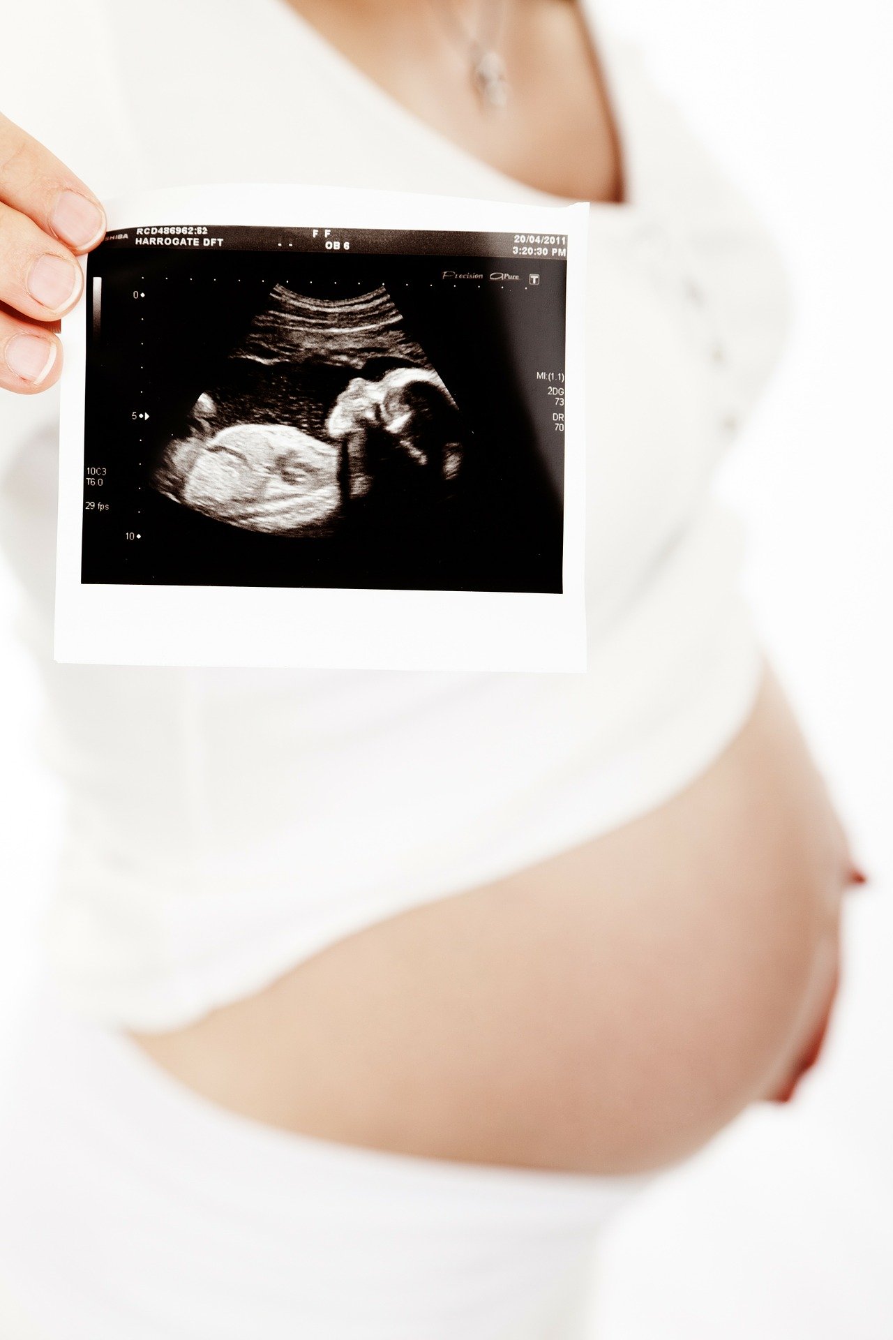 3 tydzień ciąży, planowanie ciąży, badanie usg, 1trymestr , licencja CC-BY-SA-4